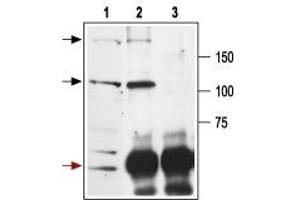 Immunoprecipitation (IP) image for anti-Glutamate Receptor, Ionotropic, N-Methyl D-Aspartate 2a (GRIN2A) (AA 41-53), (Extracellular) antibody (ABIN7043228)