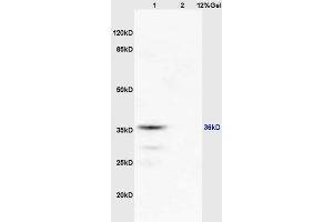Lane 1: mouse brain lysates Lane 2: mouse kidney lysates probed with Anti RASSF2 Polyclonal Antibody, Unconjugated (ABIN681988) at 1:200 in 4 °C. (RASSF2 抗体  (AA 201-300))