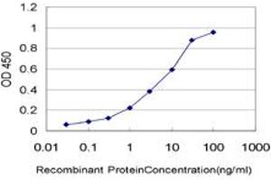 Detection limit for recombinant GST tagged STK17A is approximately 0. (STK17A 抗体  (AA 301-413))