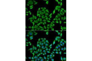 Immunofluorescence analysis of U2OS cells using UGT1 antibody (ABIN6132769, ABIN6149895, ABIN6149896 and ABIN6221779).