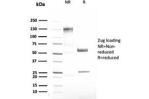 SDS-PAGE Analysis Purified Alpha-1-Antitrypsin Recombinant Rabbit Monoclonal (AAT/3167R). (Recombinant SERPINA1 抗体)