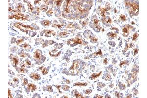 Formalin-fixed, paraffin-embedded human Pancreas stained with CFTR Monoclonal Antibody (SPM176).
