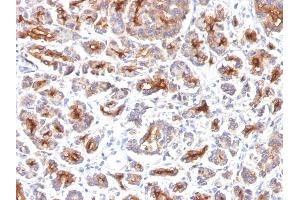 Formalin-fixed, paraffin-embedded human Pancreas stained with CFTR Monoclonal Antibody (SPM176). (CFTR 抗体)