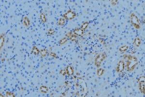 ABIN6279021 at 1/100 staining Mouse kidney tissue by IHC-P.