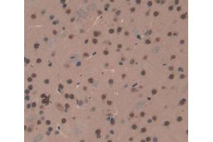 #VALUE! (Exonuclease 1 抗体  (AA 1-250))
