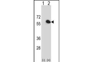 Western blot analysis of FKBP4 (arrow) using rabbit polyclonal FKBP4 Antibody (Center) (ABIN391579 and ABIN2841513). (FKBP4 抗体  (AA 186-216))