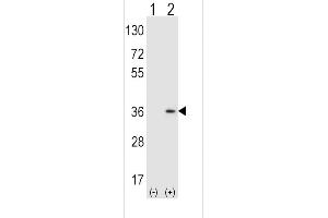 Western blot analysis of SULT1A1 using rabbit polyclonal SULT1A1 Antibody (Y143) using 293 cell lysates (2 ug/lane) either nontransfected (Lane 1) or transiently transfected (Lane 2) with the SULT1A1 gene.