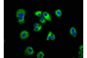 Immunofluorescence staining of HepG2 cells with ABIN7145127 at 1:166, counter-stained with DAPI. (AXIN2 抗体  (AA 11-77))