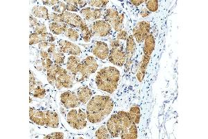 IHC analysis of RPS2 using anti-RPS2 antibody (ABIN7601997).