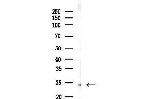 Western blot analysis of lysates from Rat liver, using TMEM187 Antibody at 1/1000 dilution.