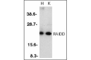 Western blot analysis of RAIDD in whole cell lysates from HeLa (H) or K562 (K) cells with RAIDD antibody at 1 µg/ml (CRADD 抗体  (Middle Region))