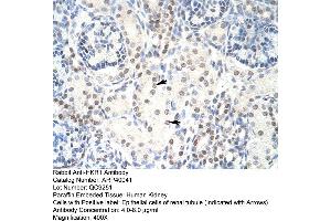 Human kidney (HKR1 抗体  (C-Term))