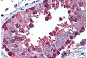 Testis, Human: Formalin-Fixed, Paraffin-Embedded (FFPE) (PDIA4 抗体  (AA 623-638))