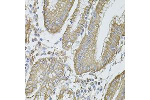 Immunohistochemistry of paraffin-embedded human stomach using FLNB antibody (ABIN5971317) at dilution of 1/100 (40x lens). (FLNB 抗体)