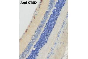 Immunohistochemistry (IHC) image for anti-Cathepsin D (CTSD) (C-Term) antibody (ABIN6254162)
