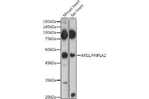 Immunofluorescence analysis of U2OS cells using ATGL/PNPL antibody (ABIN6132218, ABIN6145857, ABIN6145858 and ABIN6221844) at dilution of 1:100. (PNPLA2 抗体  (AA 265-504))