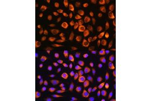 Immunofluorescence analysis of L929 cells using Hsc70/HSP Rabbit pAb (ABIN3016123, ABIN3016124, ABIN3016125 and ABIN6219558) at dilution of 1:100. (Hsc70 抗体  (AA 1-300))