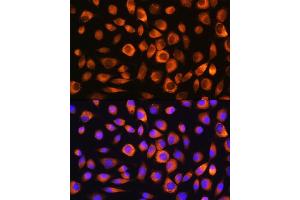Immunofluorescence analysis of L929 cells using Hsc70/HSP Rabbit pAb (ABIN3016123, ABIN3016124, ABIN3016125 and ABIN6219558) at dilution of 1:100. (Hsc70 抗体  (AA 1-300))
