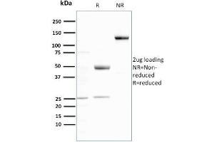 SDS-PAGE Analysis Purified Ubiquitin Recombinant Rabbit Monoclonal Antibody (UBB/3143R). (Recombinant Ubiquitin B 抗体  (AA 1-119))