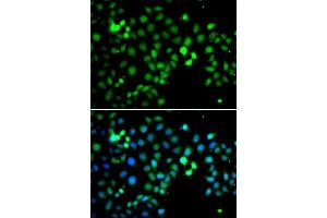 Immunofluorescence analysis of A549 cells using MTF2 antibody. (MTF2 抗体  (AA 1-190))
