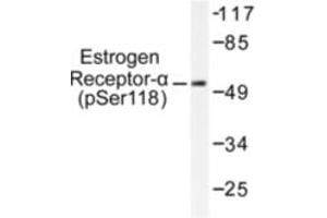 Image no. 1 for anti-Estrogen Receptor 1 (ESR1) (pSer118) antibody (ABIN318018)