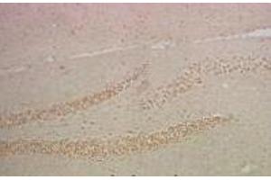 Immunohistochemistry of paraffin-embedded Mouse hippocampus tissue using NFκB-p65 Monoclonal Antibody at dilution of 1:200. (NF-kB p65 抗体)