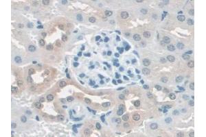 IHC-P analysis of Mouse Kidney Tissue, with DAB staining. (Caspase 4 抗体  (AA 969-1165))