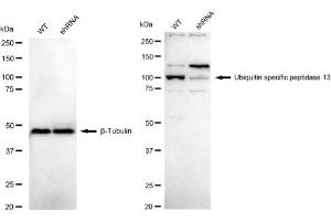 Western blotting analysis using Ubiquitin specific peptidase 13 antibody (ABIN7800726). (Recombinant USP13 抗体)