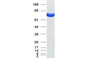 Western Blotting (WB) image for Signal Transducer and Activator of Transcription 1, 91kDa (STAT1) protein (Myc-DYKDDDDK Tag) (ABIN2732776)