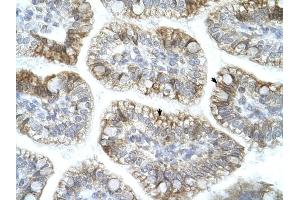 APBA1 antibody was used for immunohistochemistry at a concentration of 4-8 ug/ml to stain Epithelial cells of intestinal villus (arrows) in Human Intestine. (APBA1 抗体  (N-Term))
