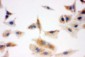 Anti-DCI antibody, ICC ICC: A549 Cell