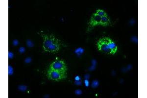 Image no. 3 for anti-Spastic Paraplegia 7 (SPG7) (AA 300-573) antibody (ABIN1491370) (SPG7 抗体  (AA 300-573))