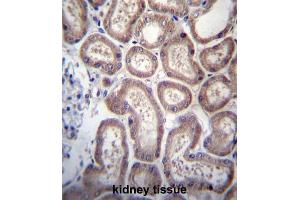 Immunohistochemistry (IHC) image for anti-SP140 Nuclear Body Protein (SP140) antibody (ABIN2997006) (SP140 抗体)