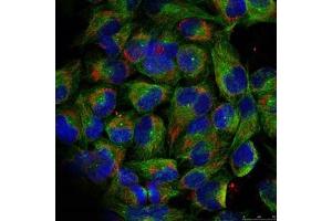 Immunofluorescence staining of methanol-fixed HeLa cells using NF-kappa,B p100 (phospho-ser866) antibody. (NFKB2 抗体  (pSer866))