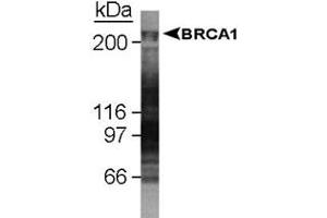 Western blot analysis of BRCA1 in U-2 OS whole cell lysate using BRCA1 monoclonal antibody, clone KEN . (BRCA1 抗体  (AA 1314-1864))