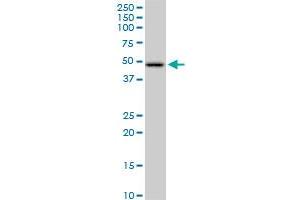 Western Blotting (WB) image for anti-Hydroxyacyl-CoA Dehydrogenase/3-Ketoacyl-CoA Thiolase/enoyl-CoA Hydratase (Trifunctional Protein), beta Subunit (HADHB) (AA 1-474) antibody (ABIN516342)