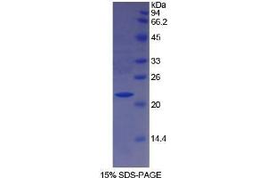 SDS-PAGE (SDS) image for Paraoxonase 1 (PON1) (AA 35-206) protein (His tag) (ABIN1525547) (PON1 Protein (AA 35-206) (His tag))
