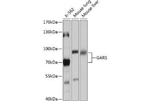 Western blot analysis of extracts of various cell lines, using GARS antibody (ABIN6127941, ABIN6140963, ABIN6140965 and ABIN6217253) at 1:1000 dilution. (GARS 抗体  (AA 60-370))