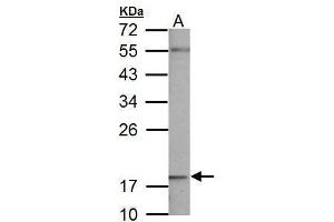 WB Image NDUFB5 antibody detects NDUFB5 protein by Western blot analysis. (NDUFB5 抗体  (C-Term))