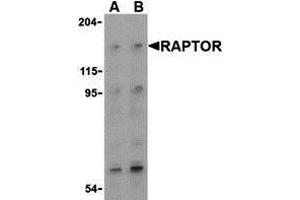 Western Blotting (WB) image for anti-RAPTOR (RAPTOR) (Middle Region) antibody (ABIN1031053) (RAPTOR 抗体  (Middle Region))