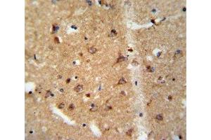 IHC analysis of FFPE human brain tissue stained with GDNF antibody (GDNF 抗体  (AA 8-36))