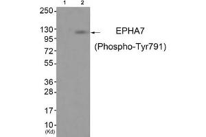 Western blot analysis of extracts from JK cells (Lane 2), using EPHA7 (Phospho-Tyr791) Antibody. (EPH Receptor A7 抗体  (pTyr791))