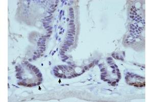 THOC1 antibody was used for immunohistochemistry at a concentration of 0. (THOC1 抗体  (C-Term))