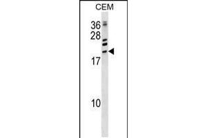 Western blot analysis in CEM cell line lysates (35ug/lane). (ATF3 抗体  (C-Term))