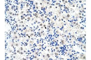 DDX47 antibody was used for immunohistochemistry at a concentration of 4-8 ug/ml to stain Hepatocytes (arrows) in Human Liver. (DDX47 抗体)