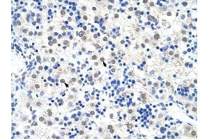 DDX47 antibody was used for immunohistochemistry at a concentration of 4-8 ug/ml to stain Hepatocytes (arrows) in Human Liver.