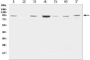 Western blot analysis of Factor VIII using anti-Factor VIII antibody (ABIN3042924).
