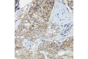 Immunohistochemistry (IHC) image for anti-Basigin (Ok Blood Group) (BSG) (AA 30-200) antibody (ABIN1512647)