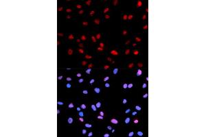 Immunofluorescence (IF) image for anti-Retinoblastoma 1 (RB1) (pSer795) antibody (ABIN1870564) (Retinoblastoma 1 抗体  (pSer795))