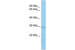 Host:  Rabbit  Target Name:  Tmem178  Sample Type:  Mouse Stomach lysates  Antibody Dilution:  1. (TMEM178 抗体  (N-Term))